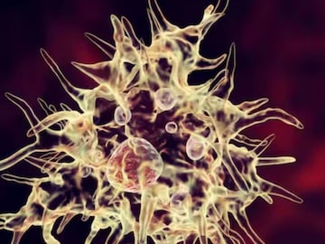 അമീബിക് മസ്തിഷ്ക ജ്വരം അമീബിക് മസ്തിഷ്ക ജ്വരം